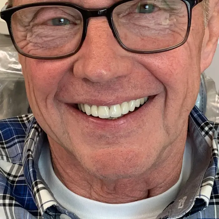 After treatment — A refreshed, natural-looking smile