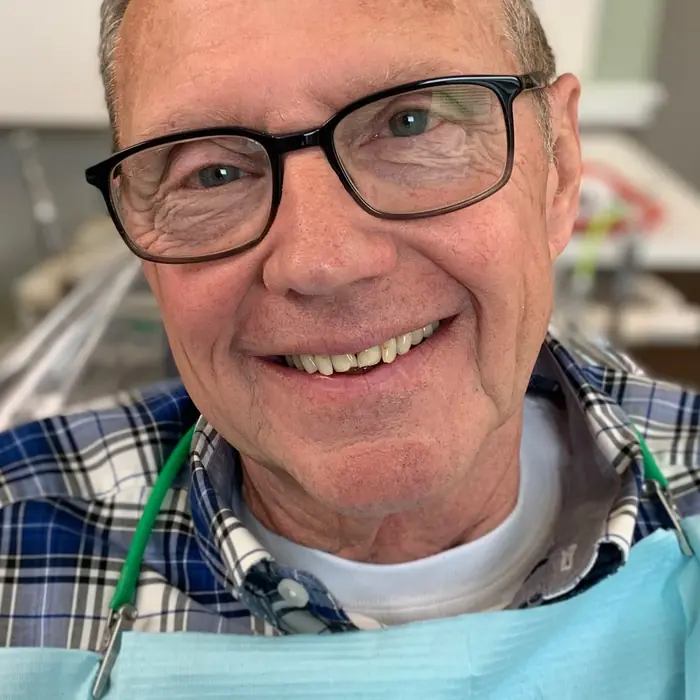 Before treatment — A refreshed, natural-looking smile