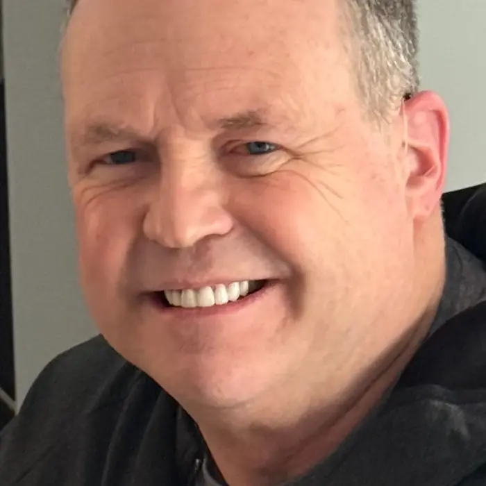 After treatment — A cleaner, brighter smile