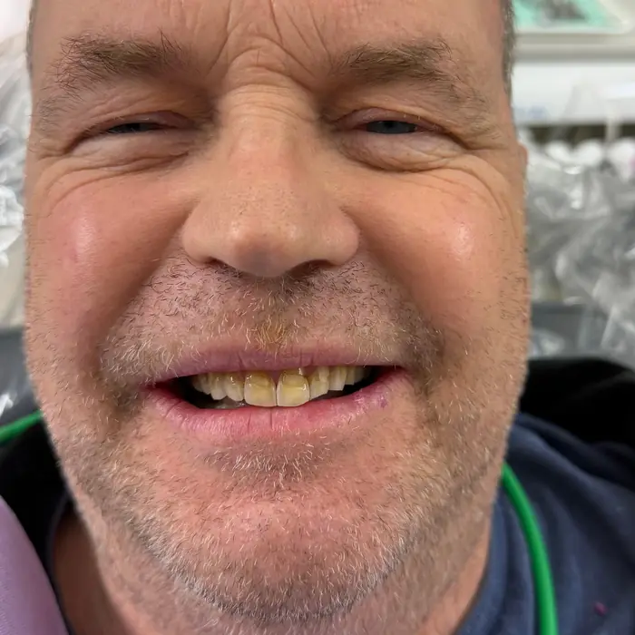 Before treatment — A cleaner, brighter smile